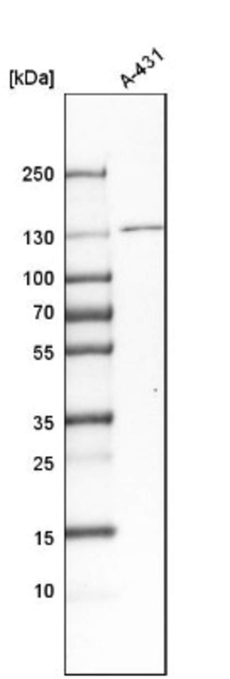 O-GlcNAcase (OGA, NAG or MGEA5) Assay Kit