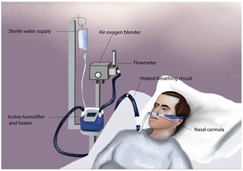 O2 Therapy With Neonatal & Peds Flashcards Quizlet