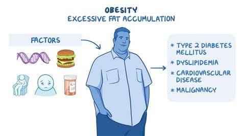 Obesity - World Health Organization (WHO) - raincitystudios.com