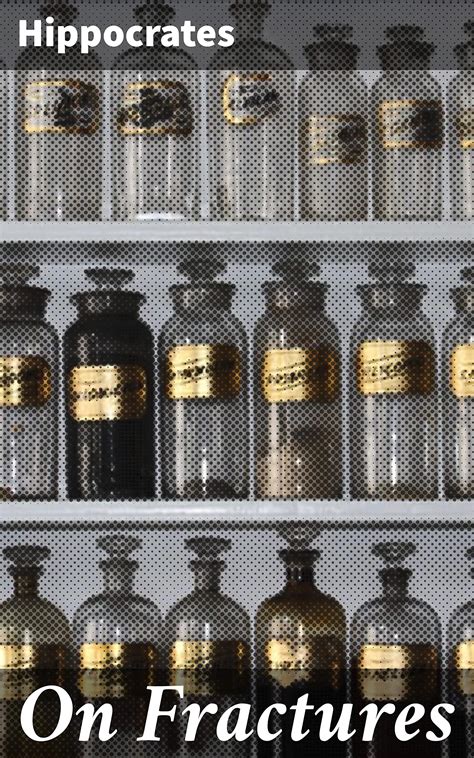 On Fractures: Enriched edition. Exploring Ancient Orthopedics: A ... - wintechmobiles.com