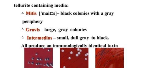 Online Microbiology Notes - muktibox.com