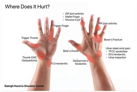 Optimal Hand Positions to Reduce Knuckle Stress While Digging - raincitystudios.com