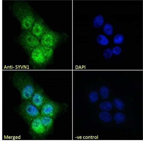 OR4C5 Polyclonal Antibody (PA5-83971)