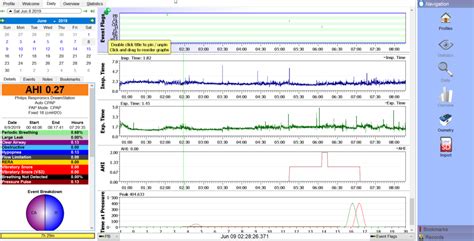 OSCAR, the Open Source CPAP Analysis Reporter 1.6.0 Snaps 1