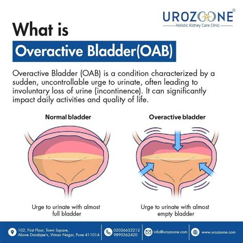 Overactive Bladder (OAB) - Urology Care Foundation - muktibox.com