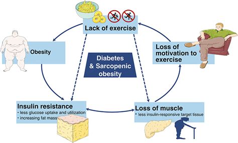 Obesity and Diabetes - PubMed