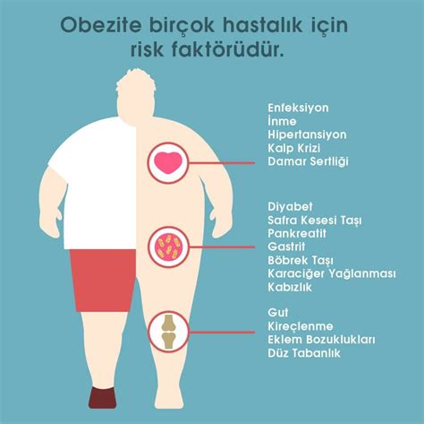Obezite resmi çizimi