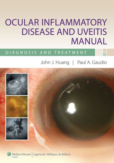 Ocular inflammatory disease and uveitis manual diagnosis and treatment. - 2009 pontiac solstice service repair manual software.