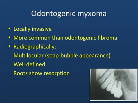 Odontogenic Cysts and Neoplasms - PubMed