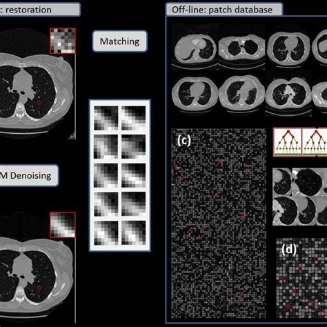 Of A Ct Dose Low Restoration Database Using Image