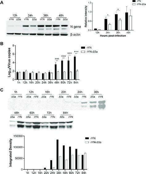 Offspring of Venezolan contrary leader speaks.