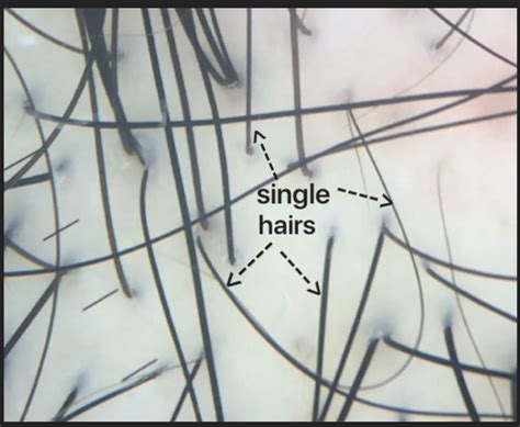 Often referred to as AGA,