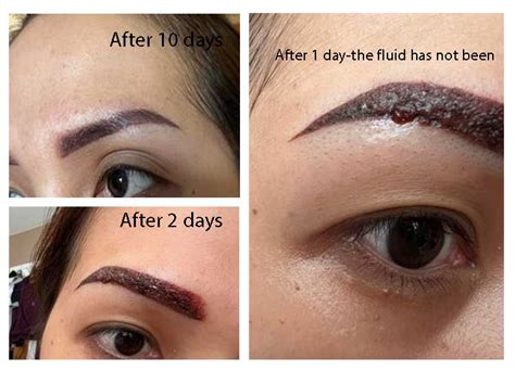 Ombre brows healing process.  - Duration: This procedure can last between 12...
