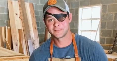 Chase Looney has an eye patch and not a prosthetic eye, as anyone who has watched Fixer to Fabulous episodes can already tell. His eyes got injured in an accident as explained by him in a blog post. On the well-liked HGTV home repair program "Fixer To Fabulous," Chase Looney is the eye-patch-wearing carpenter and construction manager..