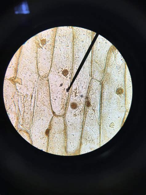 Onion cell under microscope 40x - 2. Place the carefully prepared microscope slide in position and keep in place firmly gripped with the clips. 3. Look through the microscope’s eyepiece and then move the focus knob carefully for the image to come into clear focus. 4. Slightly adjust the microscope’s condenser and amount of illumination for optimum light intensity.