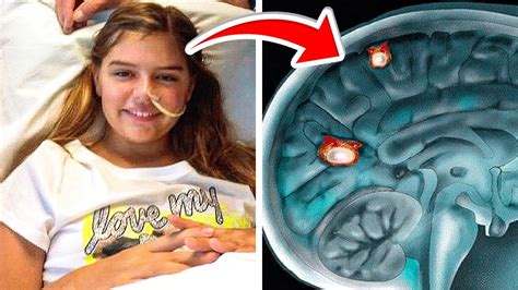 Only 4 people have survived brain-eating amoeba. She's one of them.