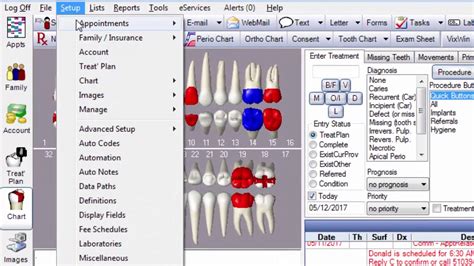 Open Dental Progress Notes YouTube