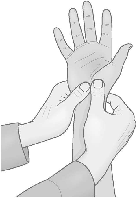 Open carpal tunnel release Clinical Tree