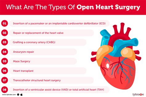 Open heart surgery - SlideShare