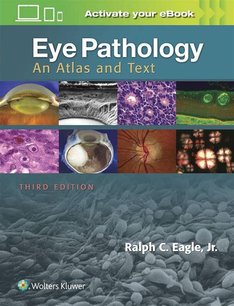 Ophthalmic pathology an atlas and textbook. - Nouvelle découverte d'une méthode peu couteuse, efficace et assurée de traiter toutes les personnes décédés.