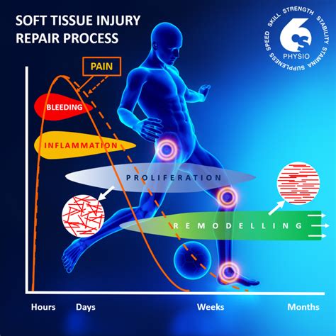 Optimal Loading of Soft Tissue Injuries by Philip Young