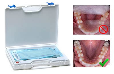 Oral photo.  Front surface coating ensures that there are no double or "ghost...