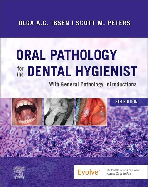 Read Online Oral Pathology For The Dental Hygienist By Olga Ac Ibsen