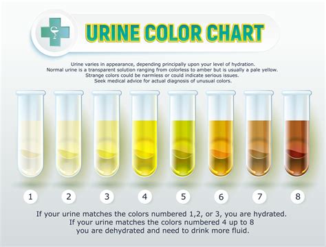 Orange Urine Color – Causes and Other Symptoms