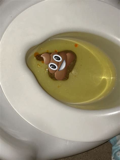 Orange oily feces. Summary. Orange poop can occur as a result of consuming too much beta carotene or as a side effect of some medication. If your poop is a pale or orange-red color, this may be a result of an underlying bowel or digestive problem. Contact your doctor if you notice new or persistent changes in your bowel habits. 