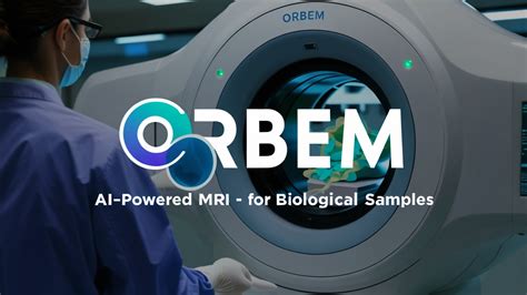 💦 Orbem Leaked [HD]