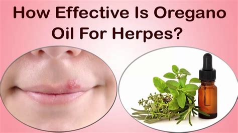 Oregano oil herpes simplex. Posted 8 years ago, 3 users are following. YankieDoodle. Recently I have had some success with suppressing my HSV2 outbreaks after many many months of back-to … 