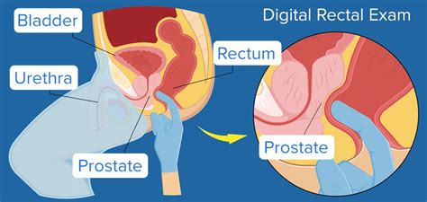 Orgasm from prostate massage. .  <a href=http://auth.bagelstudio.co/nhto4/inde...
