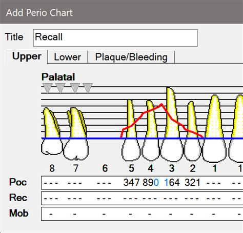 Original Perio Charting EXACT Help Centre