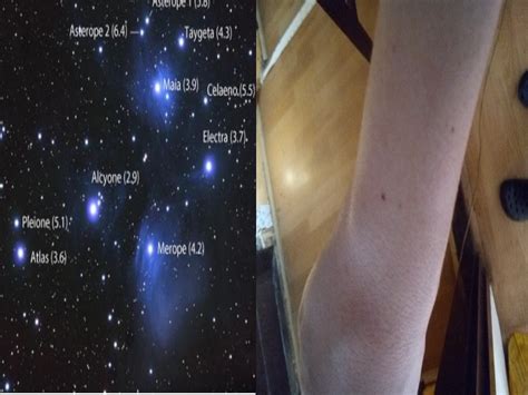 Orion starseed birthmarks. Things To Know About Orion starseed birthmarks. 