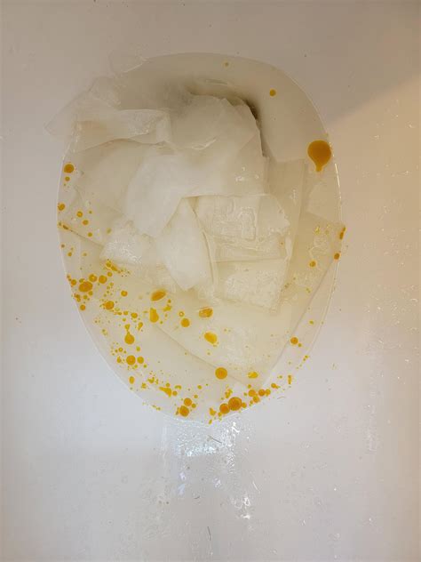 Orange poop can also be caused by a blockage in the bile ducts, which are the tubes that transport the bile liquid from the liver into the small intestine. If the bile can't get to the small intestine, the stool will not absorb it and thus will remain orange. Reasons, why the bile ducts may be blocked, can vary widely.