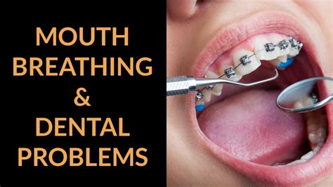 Orthodontic Treatment for Mouth Breathing Issues