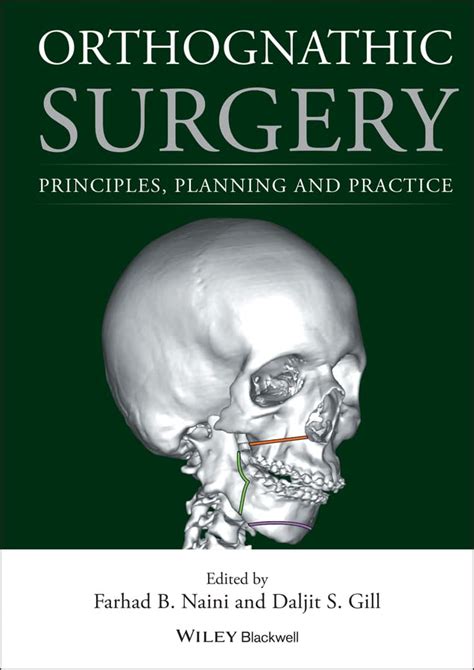 Full Download Orthognathic Surgery Principles Planning And Practice By Farhad B Naini