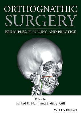 Full Download Orthognathic Surgery Principles Planning And Practice By Farhad B Naini