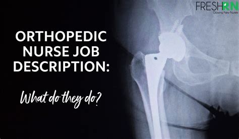 Orthopedic Nurse Job Description: What Do They Do? - FreshRN