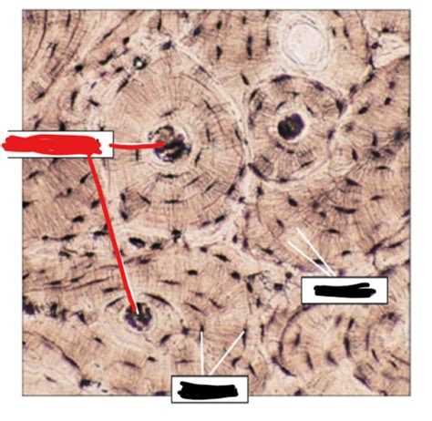 Osseous Tissue Flashcards Quizlet