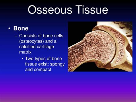 Osseous structures unremarkable. Policy. For unknown reasons, ligaments in the back where they attach to the spine calcify into a bone-like material. This process is called ossification. It mostly affects the middle (thoracic ... 