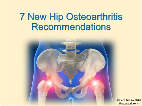 Osteoarthritis of right hip icd 10. Things To Know About Osteoarthritis of right hip icd 10. 