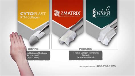 Osteogenics - Osteogenics researches and develops a variety of regenerative therapies and bone grafting products for implant dentistry. According to a press release from Envista, bone grafting and these regenerative therapies promote bone stability, a key aspect in implant dentistry. Envista will expand in the regenerative field through this acquisition ...
