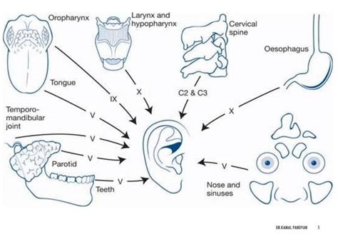 Otalgia Or Ear Pain - DNB Mentors