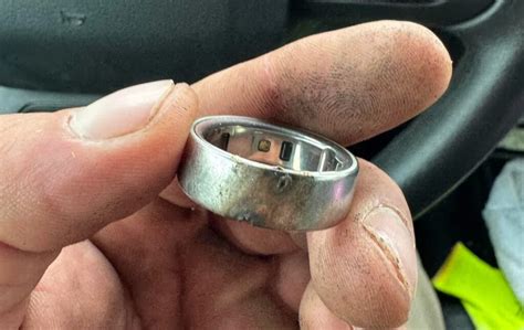 Oura Ring Overheating & Smoking: What You Need to Know | Smart Ring Safety Concerns (2026)