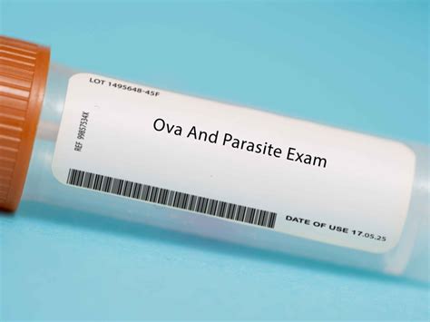None Ova and Parasites Examination test cost minimal is in Walk-In Lab (Ova and Parasites Examination Stool Test) with price $88.00. Ova and Parasites Examination test cost max is in Personalabs (Ova and Parasite Stool Test) with price $224.00. This laboratory test is available in 5 online lab test stores. $88.00. Walk-In Lab.. 