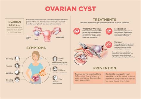 Ovarian Cysts: Causes, Symptoms and Treatments Bupa UK