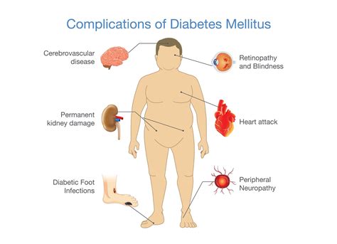 Over Medication of Diabetes Can Cause Health Problems