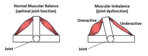 Overactivated Definition & Meaning YourDictionary