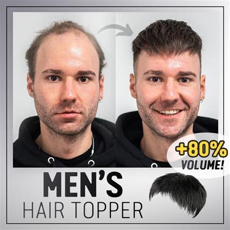 Overcome Hair Loss with the Game-Changer: Men's Hair Toppers